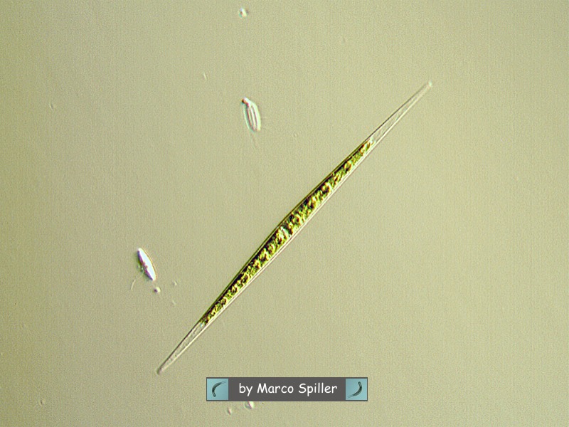 Closterium pronum....o che altro ?